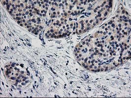TMOD1 / Tropomodulin 1 Antibody (clone OTI1F2)