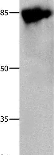 CALD1 / Caldesmon Antibody