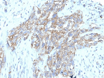 NCAM / CD56 Antibody (clone 56C04 + 123C.D5)