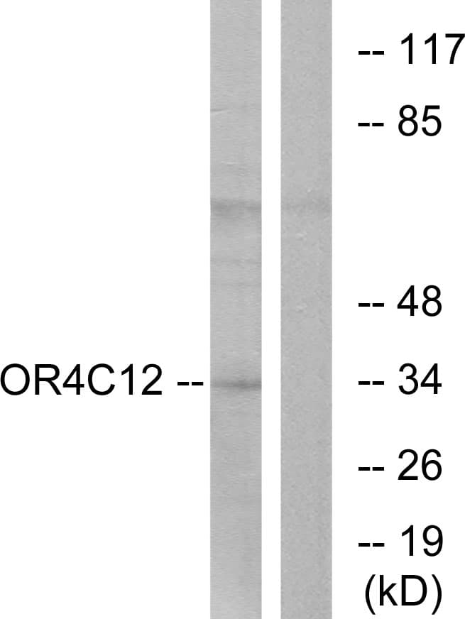 OR4C12 Antibody (aa260-309)
