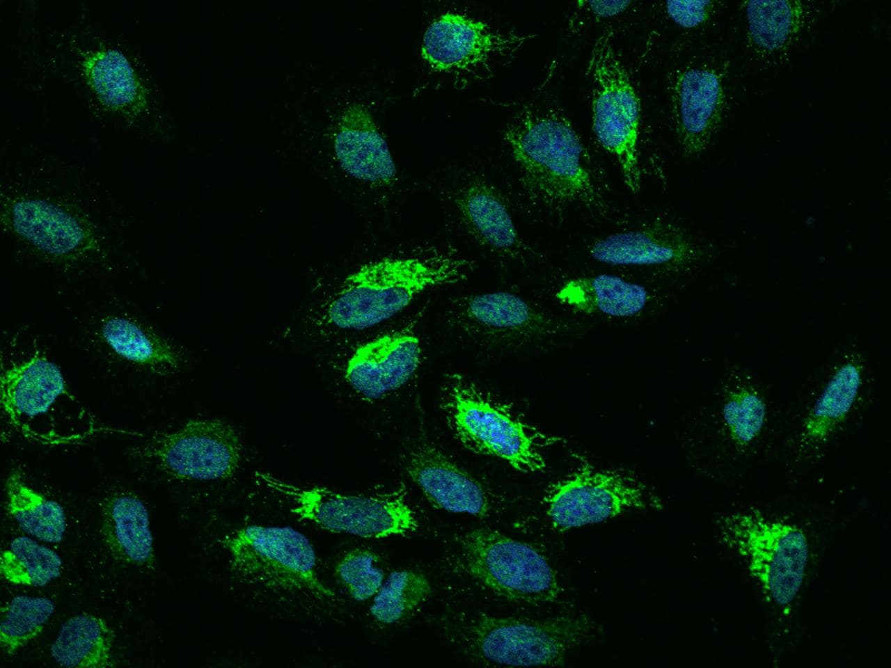 Polyclonal Rabbit anti-Human NDUFB5 Antibody (IHC, IF)