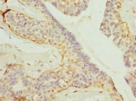 GDAP1 Antibody