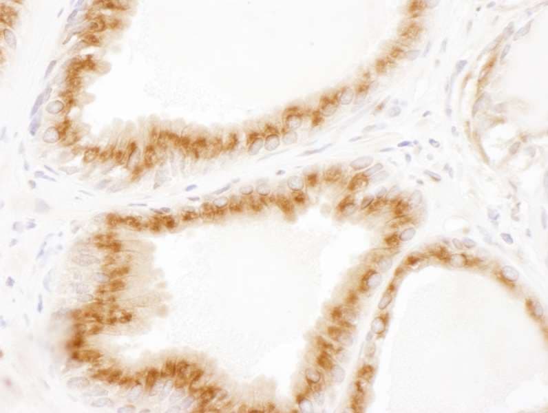 Polyclonal Rabbit anti-Human US01 / p115 Antibody (aa912-962, IHC, WB)