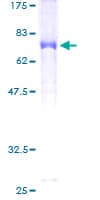 Human C17orf75 Protein (Recombinant GST)