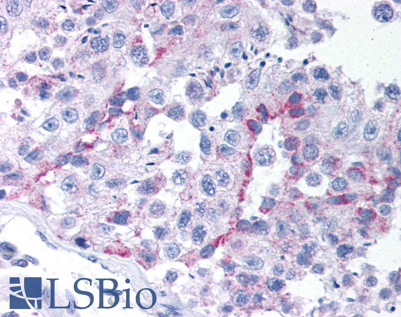 IHC-plus™ TBX6 Antibody (aa361-377)