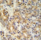 TXNDC12 Antibody (aa144-172)