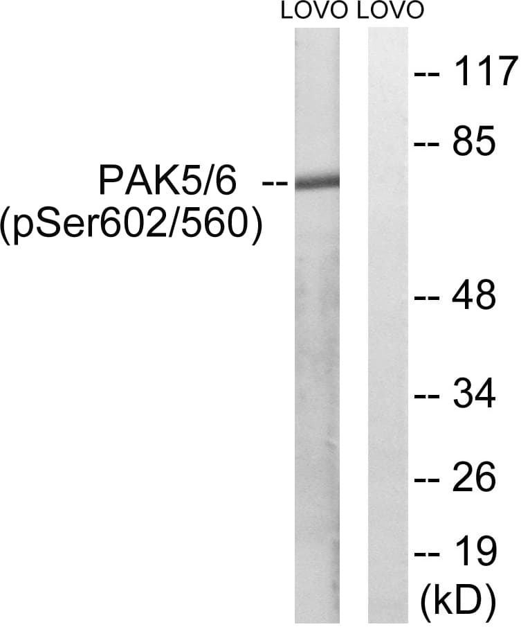 PAK5 + PAK6 Antibody (phospho-Ser602/)