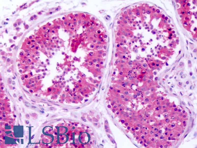 IHC-plus™ SLC1A4 / ASCT1 Antibody (N-Terminus)