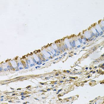 HSP90AA1 / Hsp90 Alpha A1 Antibody