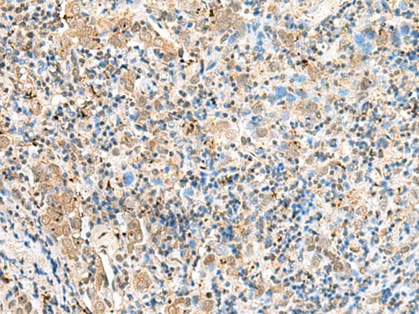 SNAPC1 Antibody