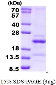 Human SRA1 / SRA Protein (Recombinant His)