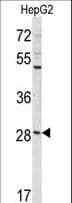 CCDC85B Antibody (aa69-96)