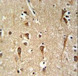 ZCCHC24 Antibody (aa136-165)