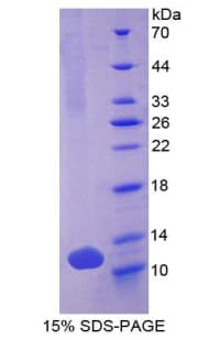 Human DEFB103A / BD-3 Protein (Recombinant His, N-Terminal)