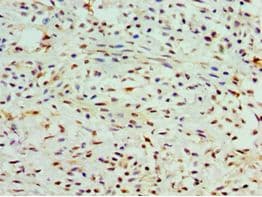 CLP / COTL1 Antibody (aa1-142)