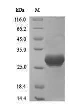 Vaccinia Virus VACWR025 Protein (Recombinant 6His, N-terminus)