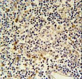 CORO6 Antibody (aa196-224)