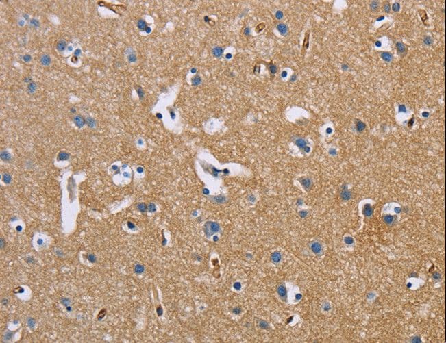 Basigin / Emmprin / CD147 Antibody