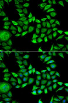 ANXA5 / Annexin V Antibody