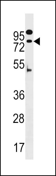 ZNF480 Antibody (aa98-126)