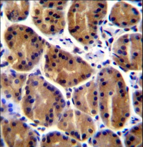 Polyclonal Rabbit anti-Human PKP2 / Plakophilin 2 Antibody (aa838-866, IHC, WB)