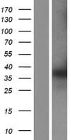 PTGR1 / LTB4DH Protein (Over-Expression Lysate Myc-DDK (Flag))