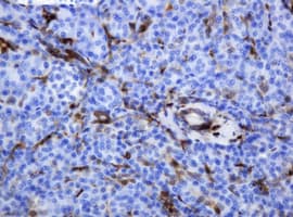 TP / Thymidine Phosphorylase Antibody (clone OTI1H7)