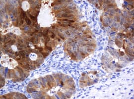 CMPK / CMPK1 Antibody (clone OTI2A2)