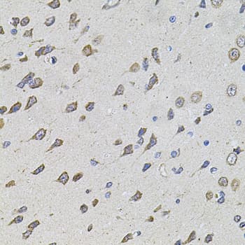 FOXO3 / FOXO3A Antibody