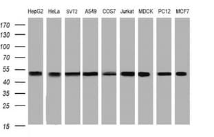 PAI-RBP1 / SERBP1 Antibody (clone OTI4G2)