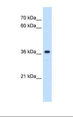 MAS1 / MAS Antibody (aa187-236)