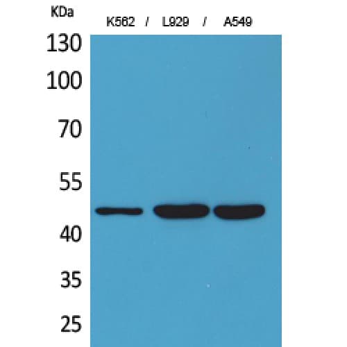 Polyclonal Rabbit anti-Human KIR3DL3 / CD158z Antibody (221-270 aa, Internal, WB)
