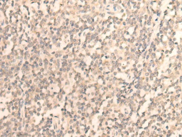 DAZ1 / DAZ Antibody