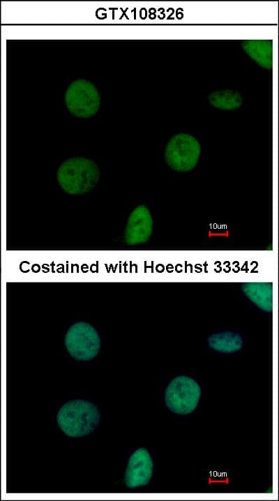 NTPCR / C1orf57 Antibody (aa127-190)