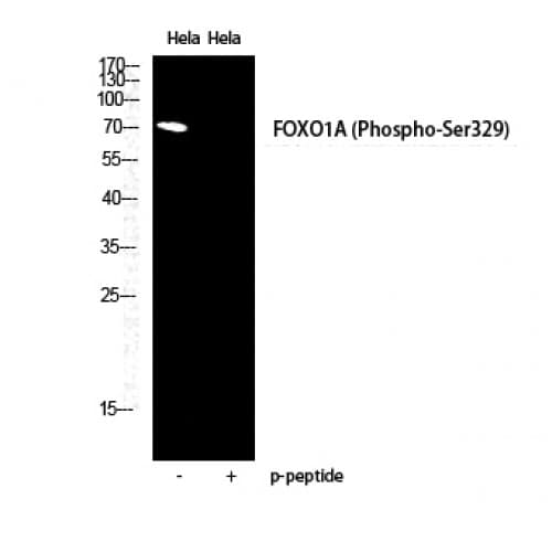 FOXO1 / FKHR Antibody (270-350 aa)