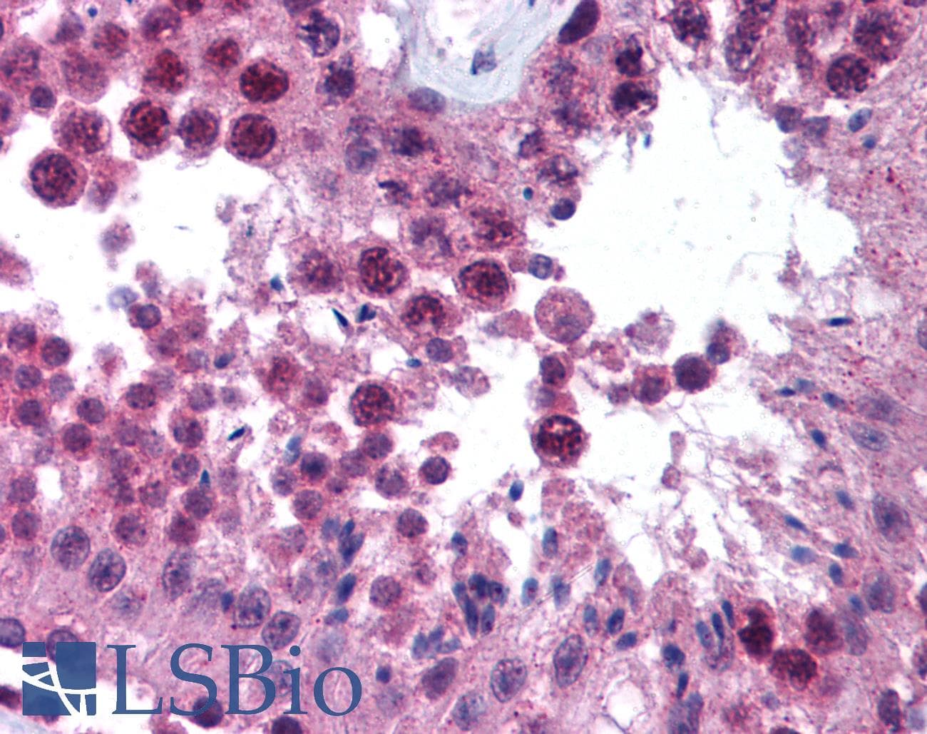 IHC-plus™ ESET / SETDB1 Antibody