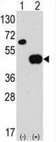 Polyclonal Rabbit anti-Human APG4B / ATG4B Antibody (aa16-45, IHC, WB)