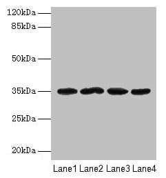 METRNL Antibody (aa46-311)