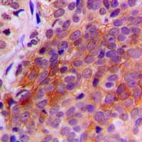 TXNRD2 Antibody (C-Terminus)