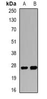IHC-plus™ Polyclonal Rabbit anti-Human CCN5 Antibody (IHC, WB)