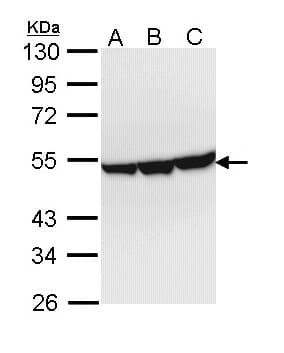 IHC-plus™ Polyclonal Rabbit anti-Human ENO3 / Enolase 3 Antibody (aa196-434, IHC, WB)