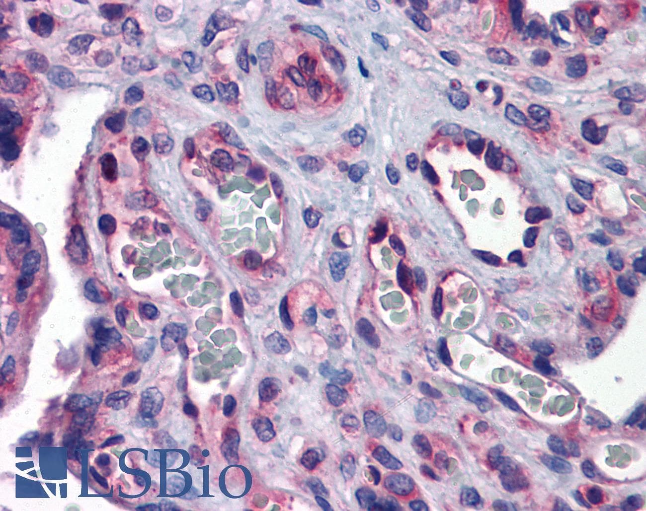 G3BP1 / G3BP Antibody (aa136-185)