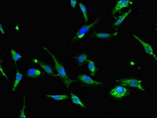 AQP2 / Aquaporin 2 Antibody