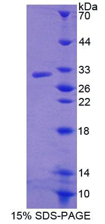 Human ABCC11 / MRP8 Protein (Recombinant His-T7)