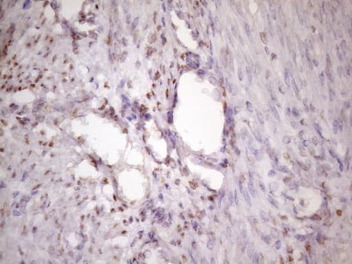 IKBKE / IKKI / IKKE Antibody (aa474-716, clone OTI3C5)