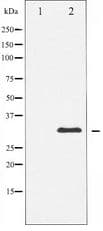 Polyclonal Rabbit anti-Human RPS6 / Ribosomal Protein S6 Antibody (WB)