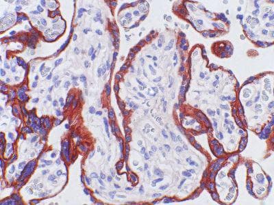 C5AR1 / CD88 / C5a Receptor Antibody (clone 3C6)