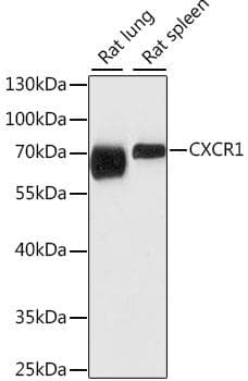 Polyclonal Rabbit anti-Human CXCR1 Antibody (IHC, WB)