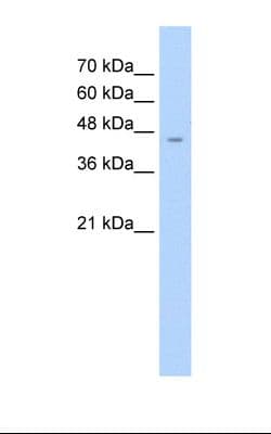 ASS1 / ASS Antibody (C-Terminus)