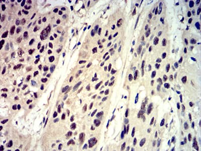 Monoclonal Mouse anti-Human EIF4EBP1 / 4EBP1 Antibody (clone 1E2E7, phospho-Ser65, IHC)